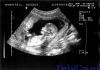 Millal tehakse raseduse ajal viimane ultraheli?