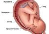 ห้อในมดลูก (retrochorial hematoma): สิ่งที่เป็นอันตรายในช่วงแรกของการตั้งครรภ์วิธีการรักษาโอกาสในการรักษาเด็ก