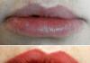 Photos before and after applying permanent lip makeup Healed lips after permanent makeup